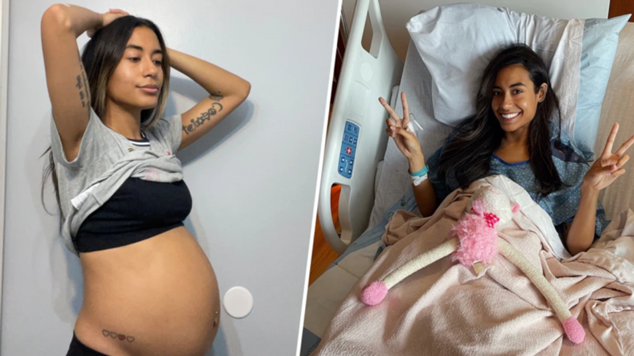 Everyone thought she was pregnant. It turned out to be a 10.5 pound ovarian cyst!