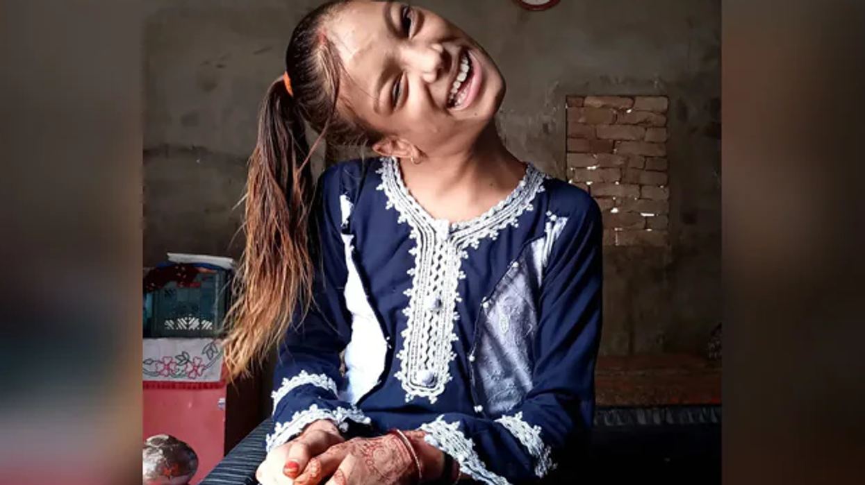 This Pakistani girl with neck bent at 90 degrees was treated successfully for free by Indian doctor