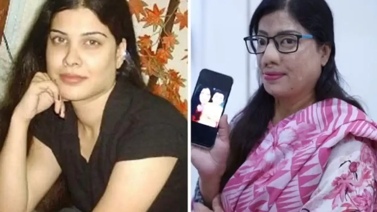 British Pakistani doctor reunites with acid attack victim he helped recover