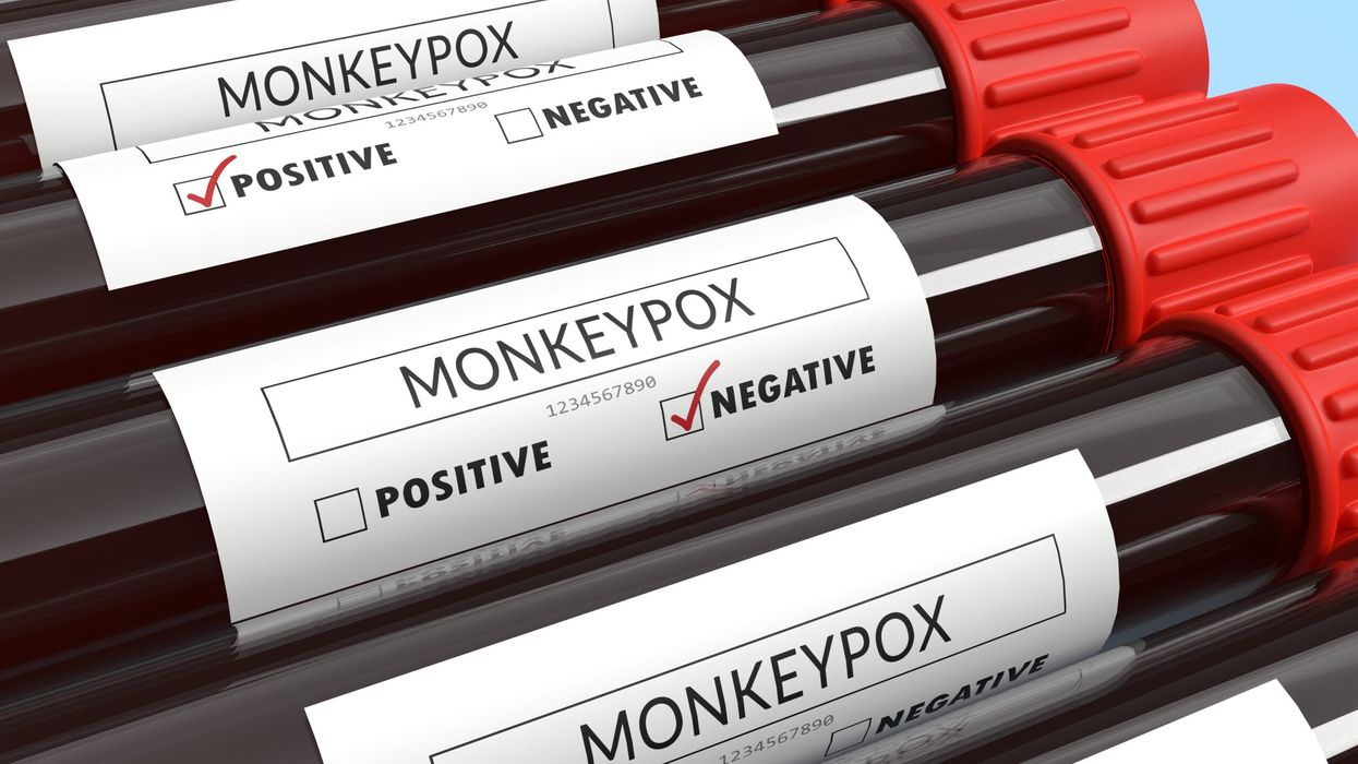 Mpox, which spreads through close contact, is generally mild but can be fatal in rare instances. (Representational image: iStock)