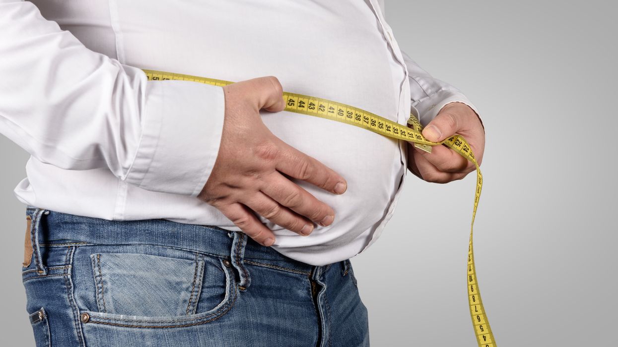 obesity-representational-iStock