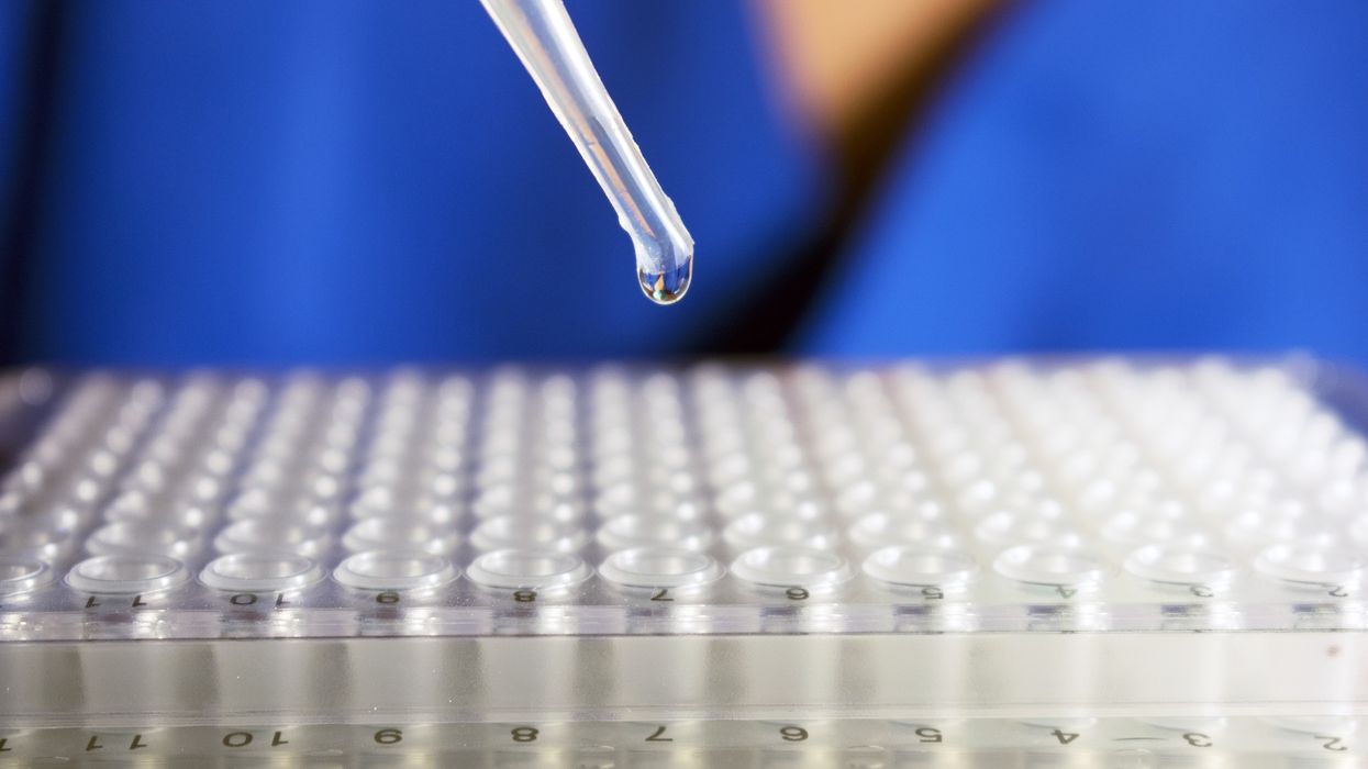 stem-cell-transplant-iStock