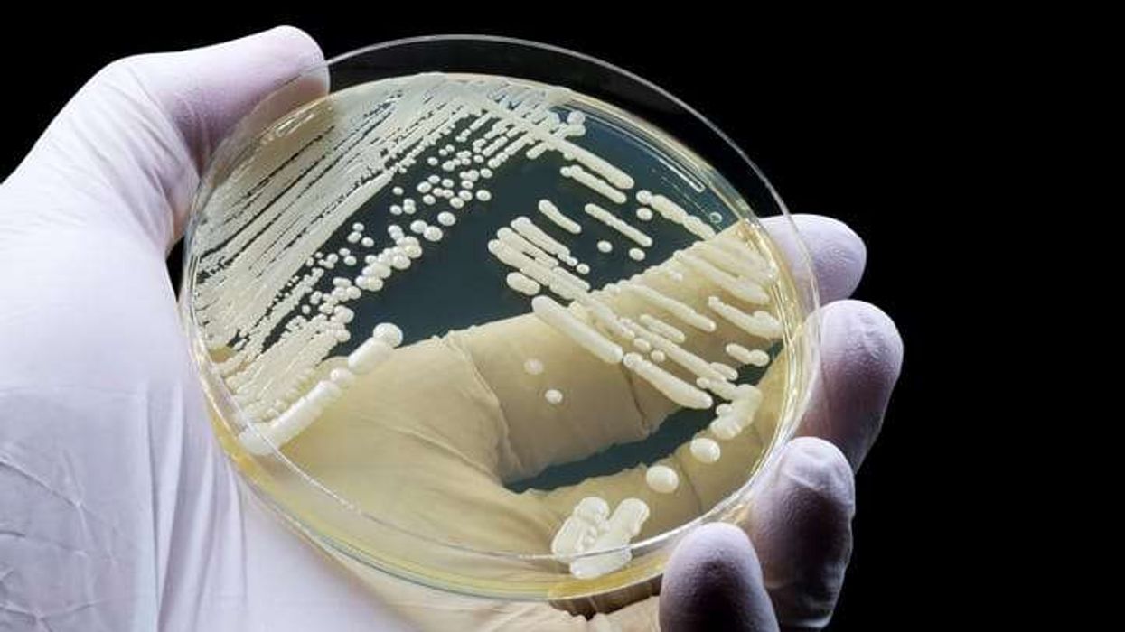 Candida auris spreads globally as scientists warn of drug-resistant 'killer fungus'