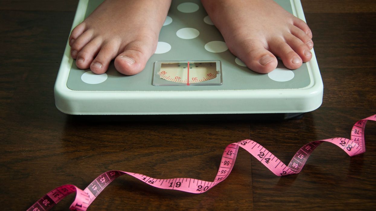 The study analysed blood samples from more than 1,300 children across various weight categories. (Representational image: iStock)