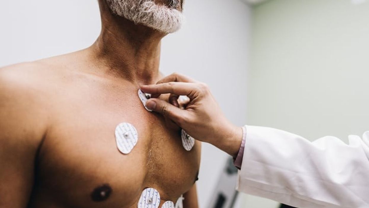 NHS trials AI tool to predict heart diseases