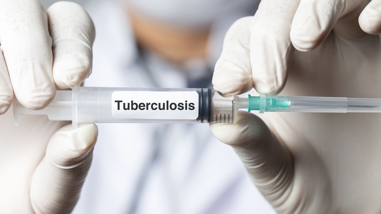 Tuberculosis-iStock