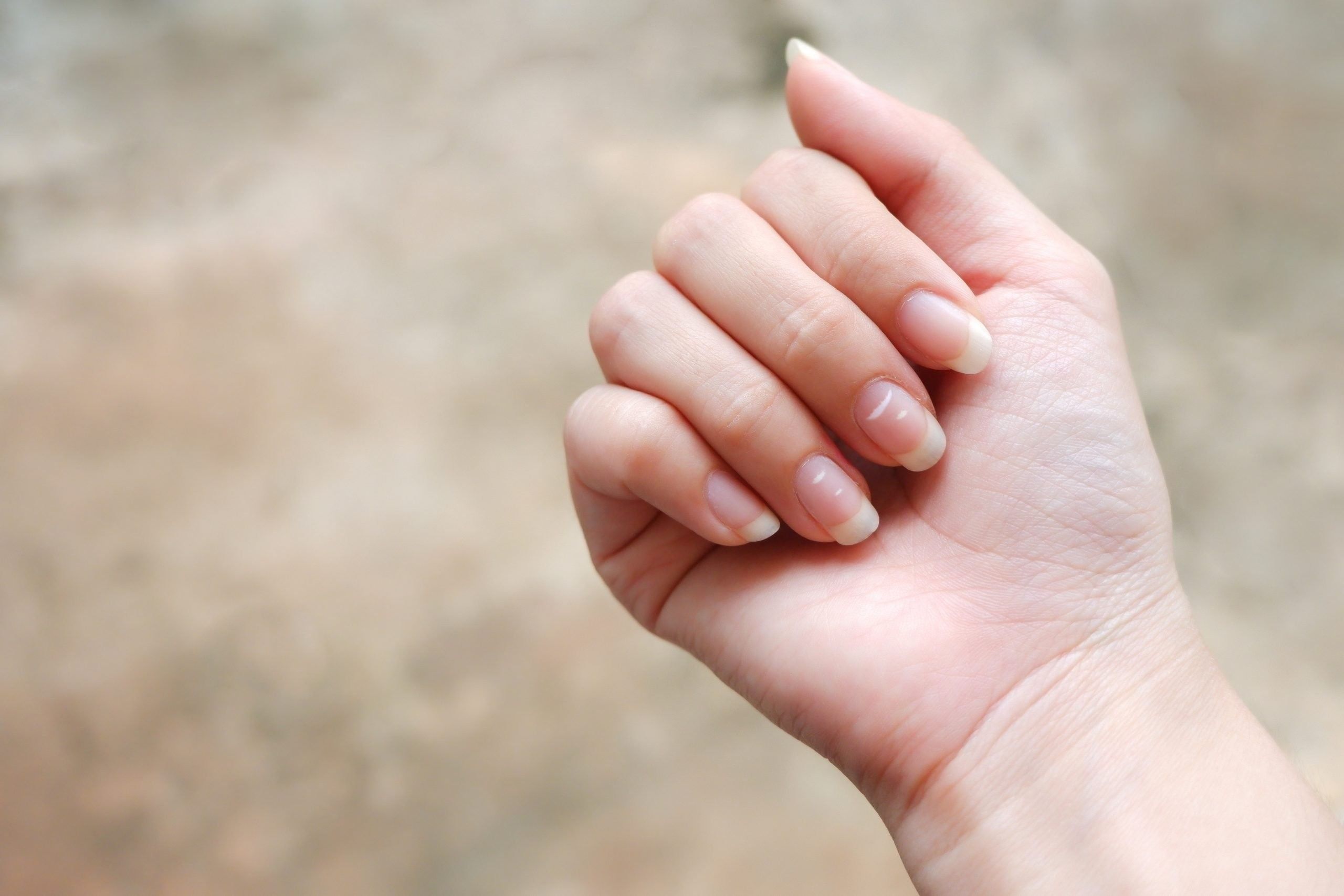 Fingernail changes in IBS, Gluten Sensitivity and Celiac Disease - Amy  Burkhart, MD, RD